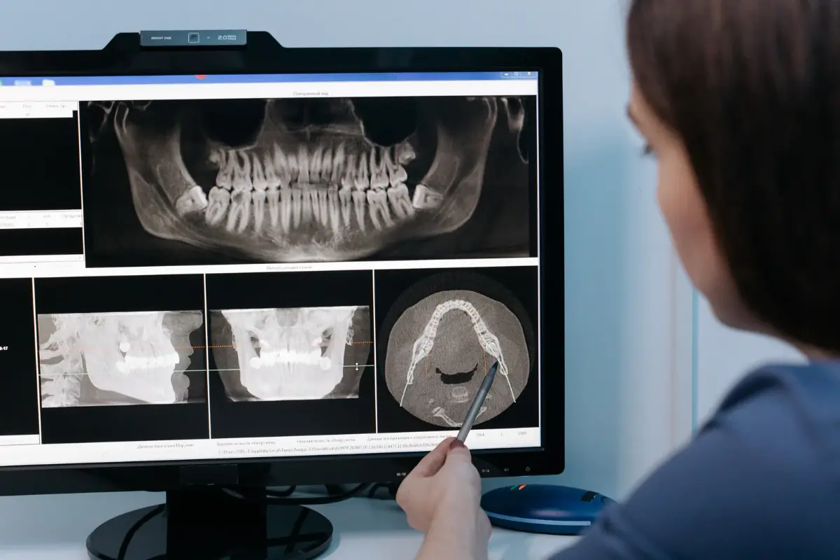3D скенер на зъбите (CBCT)