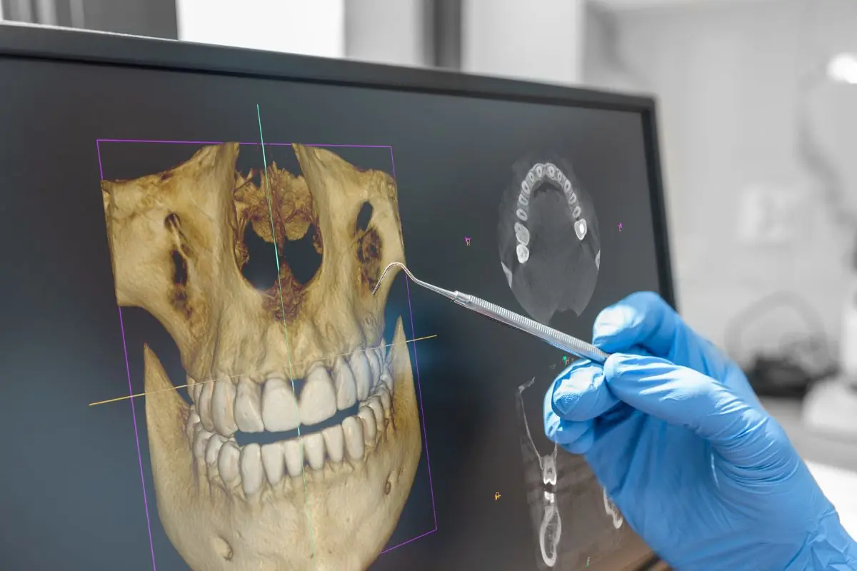 3D скенер (CBCT)